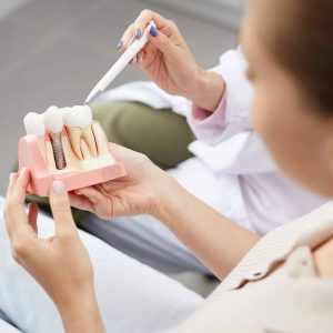 Tooth Replacement in Kitchener