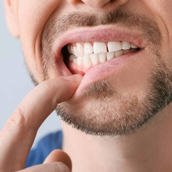 gum disease treatment in Kitchener
