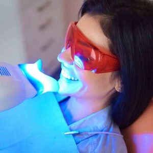 teeth whitening in Kitchener