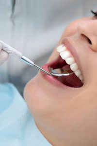 Close-up of open mouth during dental examination with metal mirror and tools inspecting teeth